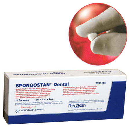 Spongostan Absorbable Hemostatic Gelatin Sponge, 1cm x 1cm x 1cm, Sterile