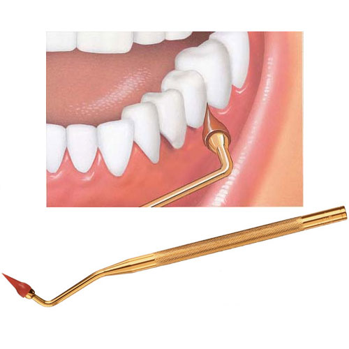 Sunstar GUM Stimulator, Handle & Tip 12/Pk. Firm Rubber Stimulator for gingival